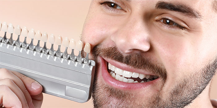 What Is The Process Of Dental Veneers?